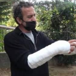 Arkadaşı Pitbulla pusu kurup saldırdı