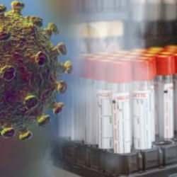 İnfluenza nedir, belirtileri nelerdir? Domuz gribi ne kadar sürer?