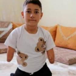 Nakşin'in tek isteği protez kol ve bacak