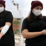 Şanlıurfa’da üniversite kampüsünde köpek saldırısı: Canımı zor kurtardım