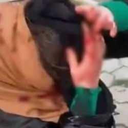 Barışma teklifini reddeden dini nikahlı eski eşine dehşeti yaşattı 