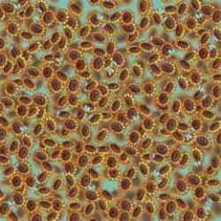 Ayçiçekleri arasında gizlenen arıyı 9 saniyede gören üstün zekalı çıkıyor! Zorlayıcı zeka testi ile kendini sına!