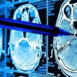 Tıp tarihinde bir ilk... T&uuml;rkiye'de ger&ccedil;ekleşti: Yapay zeka hayat kurtardı!