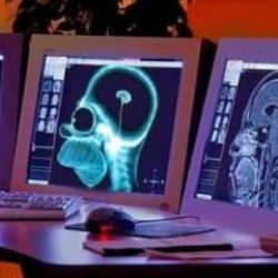 Yapay zekada kritik eşik aşıldı: Zihin okumak mümkün hale geliyor!