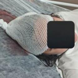 'Dehşet kamp&uuml;s&uuml;'nde bir saldırı daha! Başıboş k&ouml;pek saldırısında ağır yaralandı