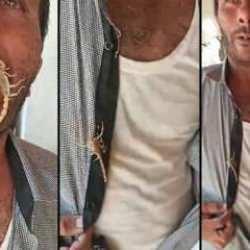 Akreplere kendini sokturdu, tedavi olduğunu iddia etti