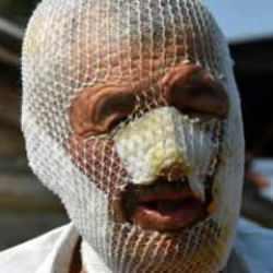 &Ccedil;anakkale'de orman yangını faciası: Dehşeti b&ouml;yle anlattı!