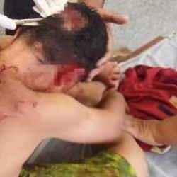 Bir k&ouml;pek dehşeti daha! &Ccedil;ocuğun kafasına 25 dikiş atıldı...