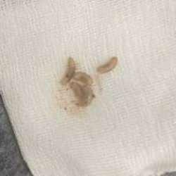 Doktorlar da şaşırdı! K&uuml;&ccedil;&uuml;k &ccedil;ocuğun kulağından 23 tane kurt&ccedil;uk &ccedil;ıkarıldı...