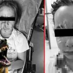 Esenyurt'ta başıboş köpek vahşeti: Kız çocuğuna dehşeti yaşattı! Valilikten açıklama