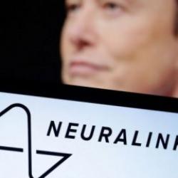 Neuralink onay aldı: Beynine çip taktırmak isteyen insanlar aranıyor!