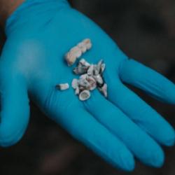 İsrail'in 'yakılan çocukların dişi' diye paylaştığı fotoğraf da sahte çıktı