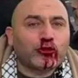 Filistin&rsquo;e destek mitinginin d&ouml;n&uuml;ş&uuml;nde saldırıya uğradı