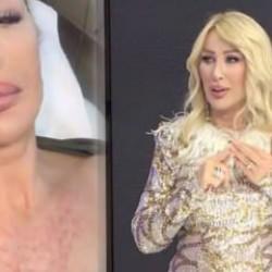 Seda Sayan&rsquo;ın akılalmaz estetik macerası! Şimdi de s&uuml;nnet derisi&hellip;