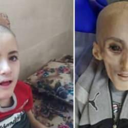 Filistinli Yezen, işgalci İsrail'in ablukası nedeniyle Gazze'de açlıktan can verdi