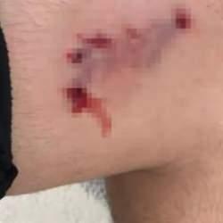 16 yaşındaki çocuk evine giderken başıboş köpeğin saldırısına uğradı!