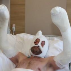 Soba yakmak isterken canından oluyordu!