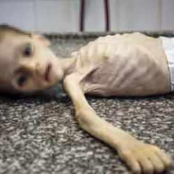 Gazze'de a&ccedil;lıktan &ouml;len &ccedil;ocuk sayısı arttı! En k&uuml;&ccedil;&uuml;ğ&uuml; 14 g&uuml;nl&uuml;k