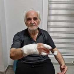 Köpek dehşeti: Duvardan atlayıp elini parçaladı