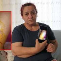 K&ouml;pekler dehşeti yaşattı, artık evden &ccedil;ıkamıyor!