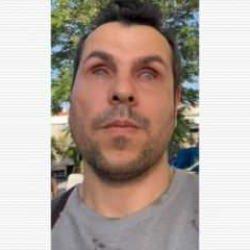 Görme engelli fenomen isyan etti: Parklardan vazgeçtik, bari işimize rahat gidip gelelim!