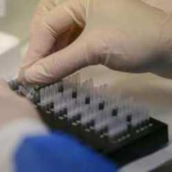 Japonya'da "et yiyen" STSS bakterisi vaka sayısı en yüksek seviyesinde