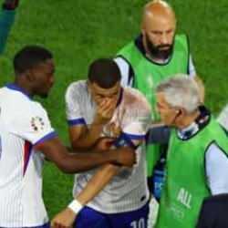 Burnu kırılan Mbappe'den Fransa'ya kötü haber! 