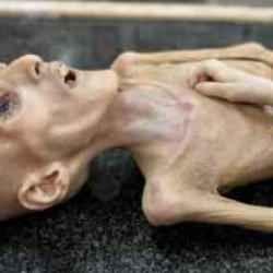 BM’den korkutan rapor! Gazze'de nüfusun yaklaşık 96'sı 'aşırı açlık'la karşı karşıya 