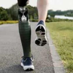 Teknolojide yeni adım: Biyonik bacak ile doğal yürüme hızı geri geliyor!