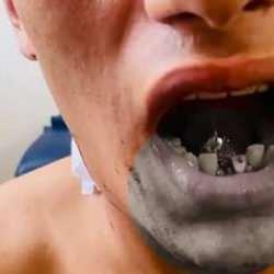 Yolda yürürken silahlı saldırıya uğradı! Boynundan giren mermi çenesine saplandı