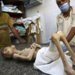  6 yaşındaki Filistinli Hikmet yetersiz beslenmeden hayatını kaybetti