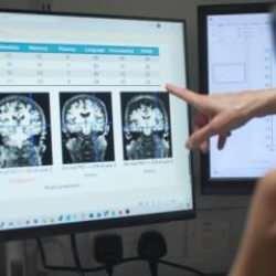 Alzheimer'a karşı mücadelede oyunun kurallarını değiştirecek!