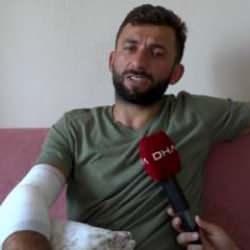 Sakarya'da saldırgan köpek, belediye personelinin kolundan et parçası kopardı