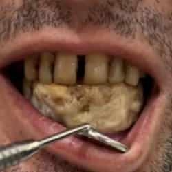 Diş kliniğine giden adam, doktoru şoka uğrattı: 'Hastamızın yeni icadı' 