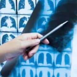 Akıllara durgunluk veren olay: Doktorlar t&uuml;m&ouml;r sanıp &ccedil;ıkardıkları şeyi g&ouml;r&uuml;nce şaşırdı