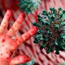 DSÖ son dakika duyurdu! 10 yıl sürebiliyor: Halk sağlığı acil durumu ilan edildi