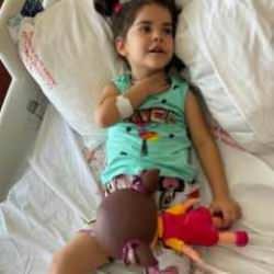 7 başıboş köpeğin saldırısına uğrayan Elif'in annesi: Çocuğum travma yaşıyor