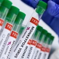 ECDC'den maymun çiçeği uyarısı