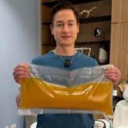 Film değil gerçek: Gençleşmek için yılda 2 milyon dolar ödüyor!