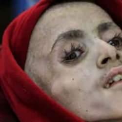 Filistinli esirler bir deri bir kemik kaldı