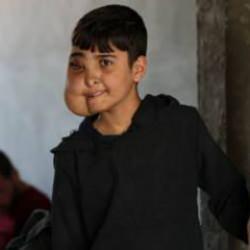 Milyonda bir görülen hastalık ile yaşıyor! Enes'ten iyi haber geldi 