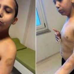 Beylikd&uuml;z&uuml;&rsquo;nde &ouml;zel bakım merkezinde otizmli &ccedil;ocuğa şiddet! 