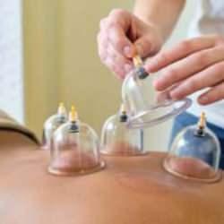 Aile hekimleri hacamat yapacak mı? Hacamatın faydaları nelerdir?