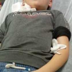 Akhisar'da başıboş köpek dehşeti: 10 yaşındaki çocuk yaralandı1