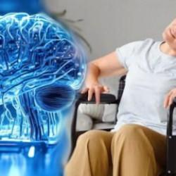 Sağlık sektöründe devrim: Yapay zeka ile felç tedavisi dönemi!