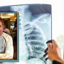 Sigara içmeyen kişilerde akciğer kanseri: Hayatına mal oldu!