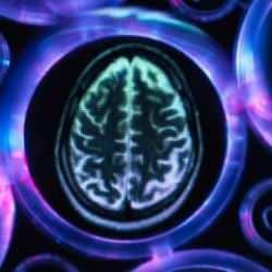 Uzaya fırlatmışlardı: Mikro insan beyinleri bilim adamlarını şaşkına çevirdi!