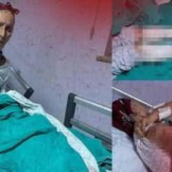 65 yaşındaki kadına 7 köpek birden saldırdı! Tam 50 dikiş atıldı