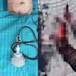 İstanbul'da pitbull dehşeti: Bacağını kaybetti