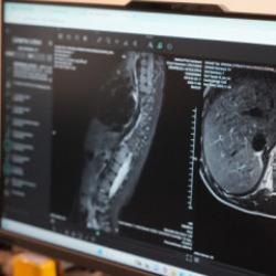 Anneler dikkat! Bu hastalığı ilk siz fark ediyorsunuz